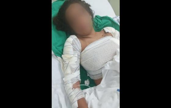 Jovem é estuprada e queimada viva