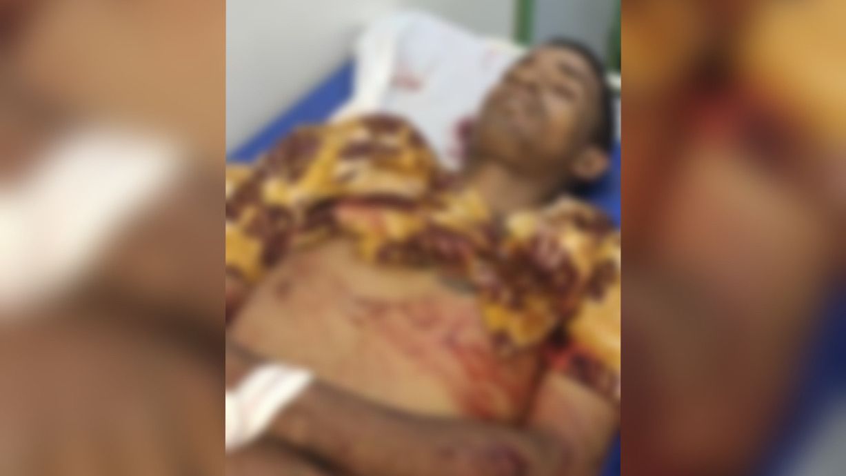 Jovem morre em troca de tiros com a PM de Parauapebas