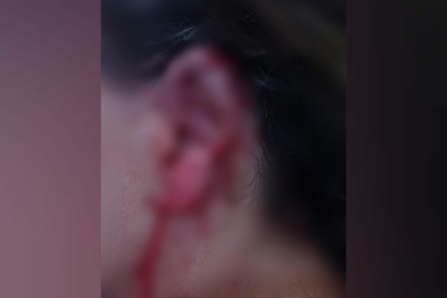 Mulher arranca pedaço de orelha de rival com a boca no interior do Pará