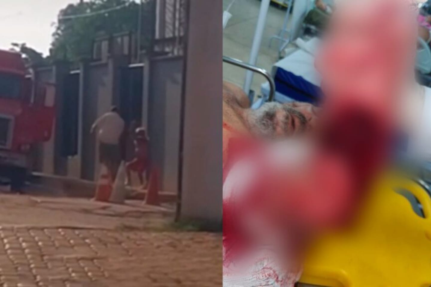 Caminhoneiro tem braço decepado durante briga no Pará