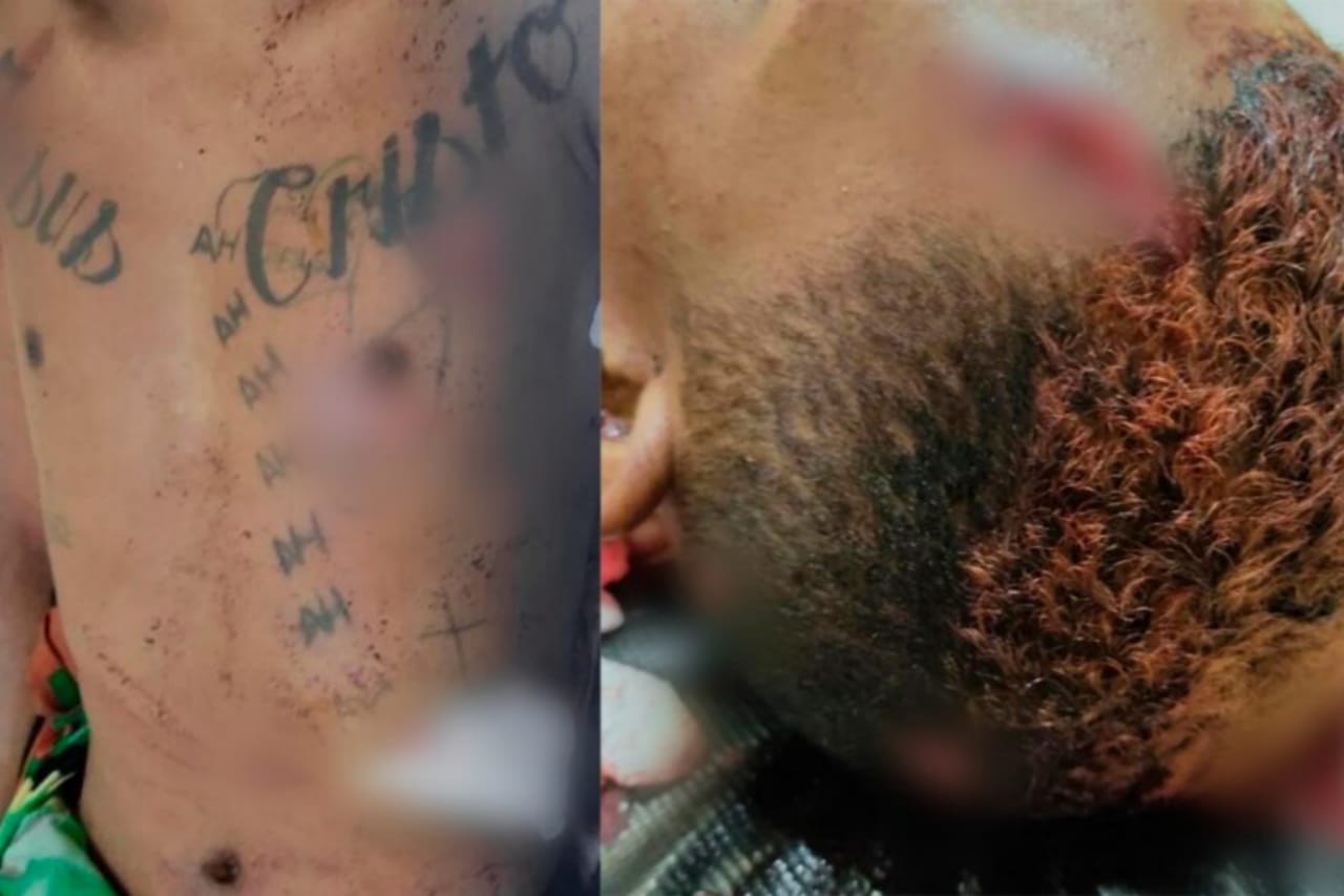 Homem sofre tentativa de homicídio e leva tiro na cabeça no Pará