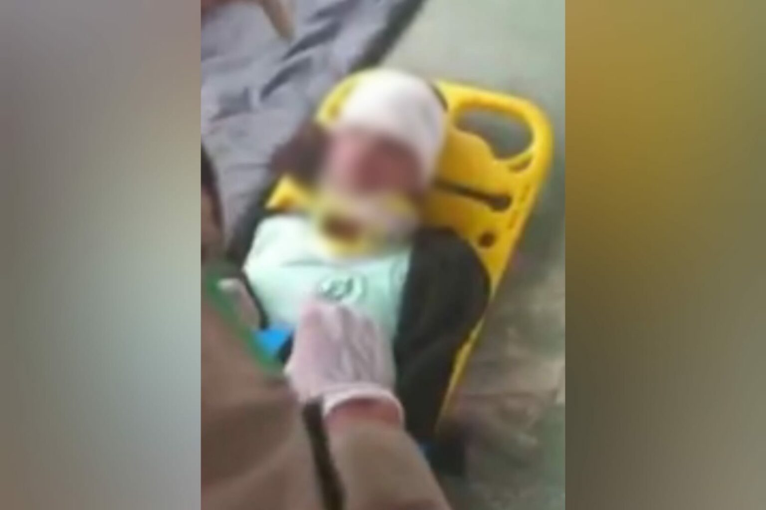 Portão de ferro cai e atinge aluna de 9 anos em escola no Pará