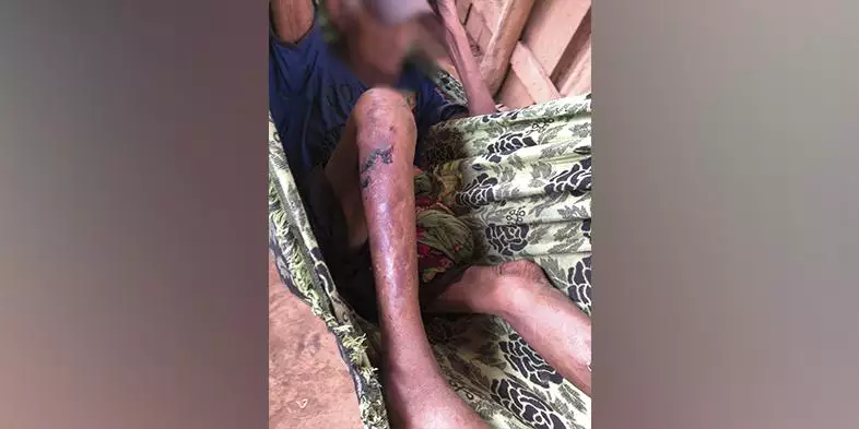 Idoso abandonado pela família é resgatado em situação precária no interior do Pará