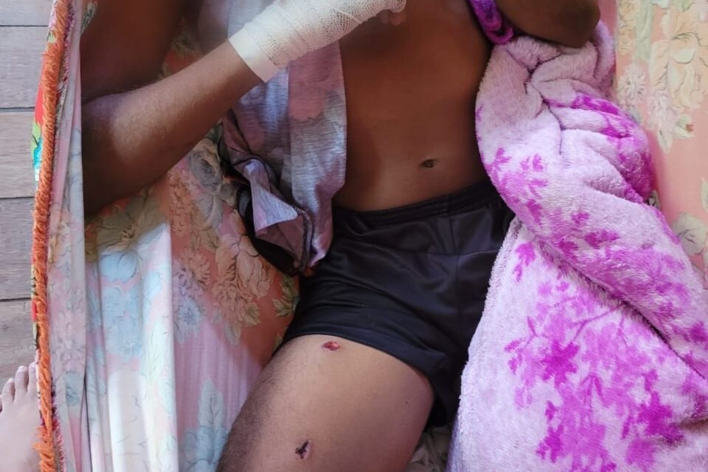 Adolescente é atacado por onça no interior do Pará