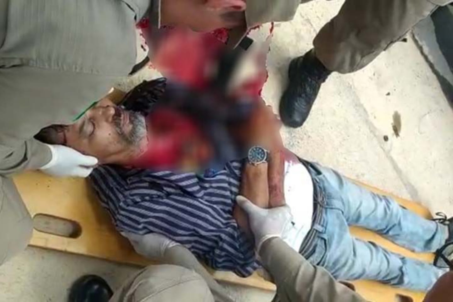 Acidente entre taxista e motociclista deixa vítima em estado grave no Pará