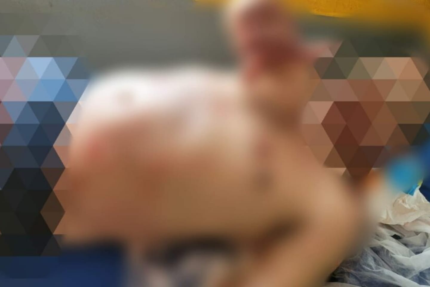 Homem sofre tentativa de homicídio em região garimpeira no Pará