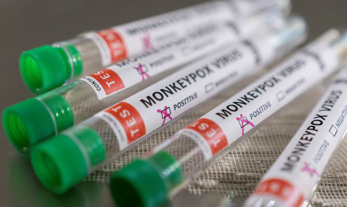 Sespa lança cartilha com orientações para a prevenção da Monkeypox
