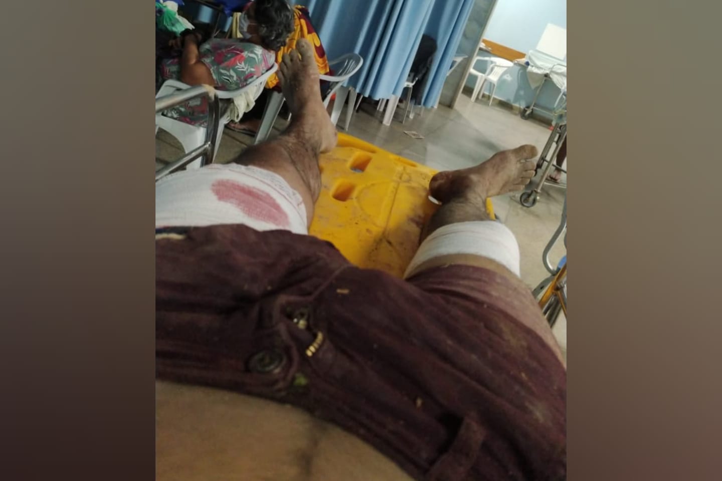 Motorista de aplicativo é baleado por criminosos em Marabá