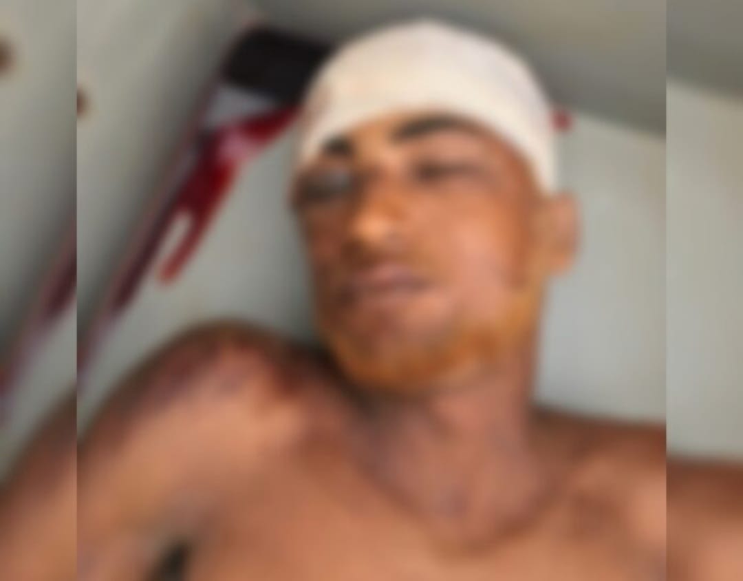 Motoqueiro embriagado cai, bate a cabeça em pedra e morre em Novo Repartimento