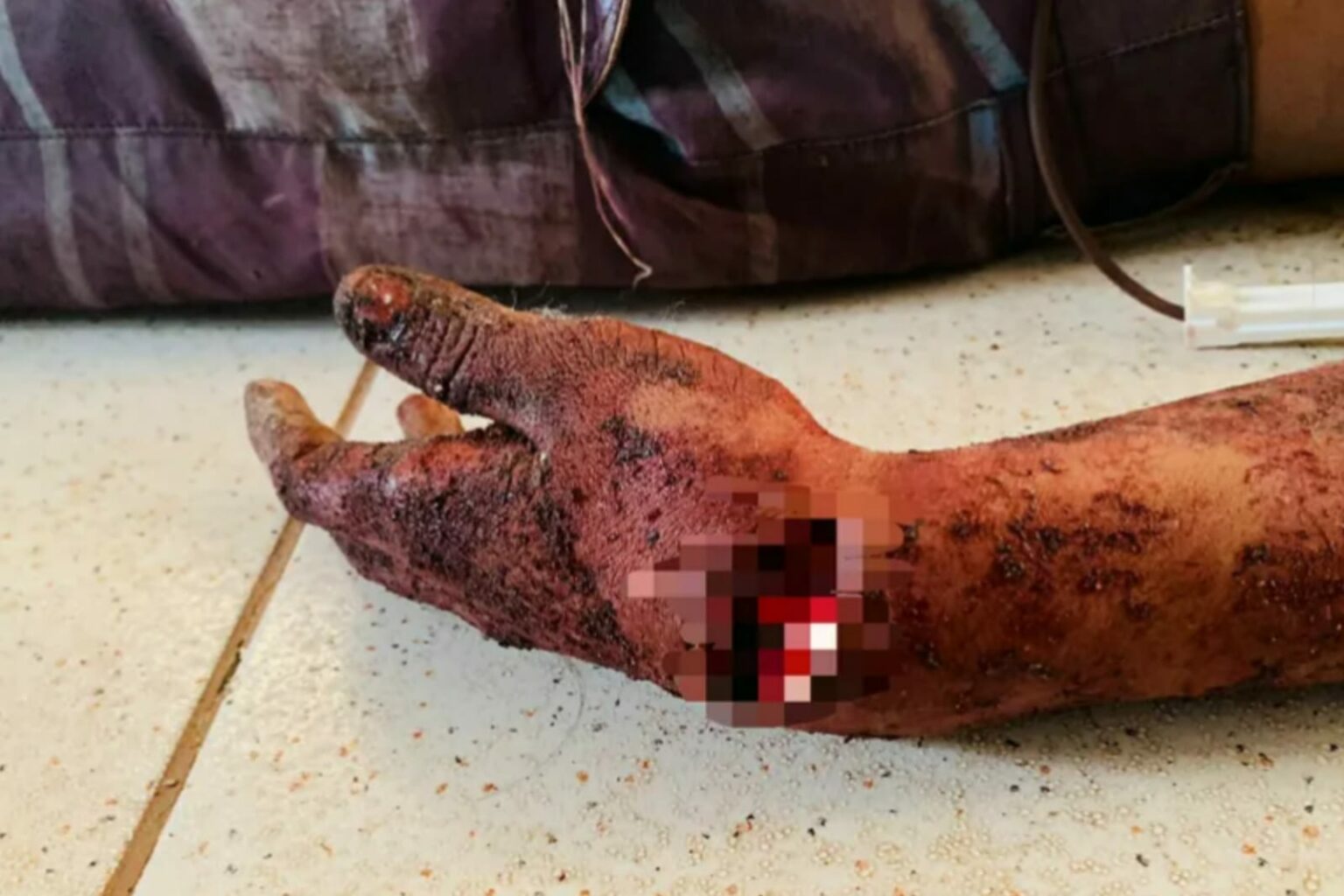 Homem é assassinado com golpes de facão no oeste do Pará