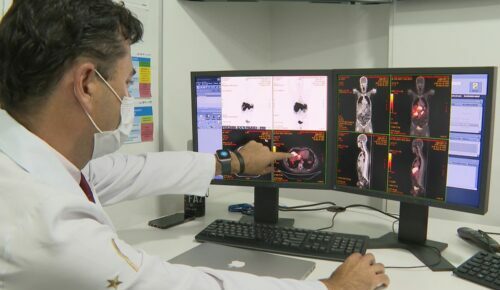 Câncer de próstata tem novo tratamento com radioterapia reduzida