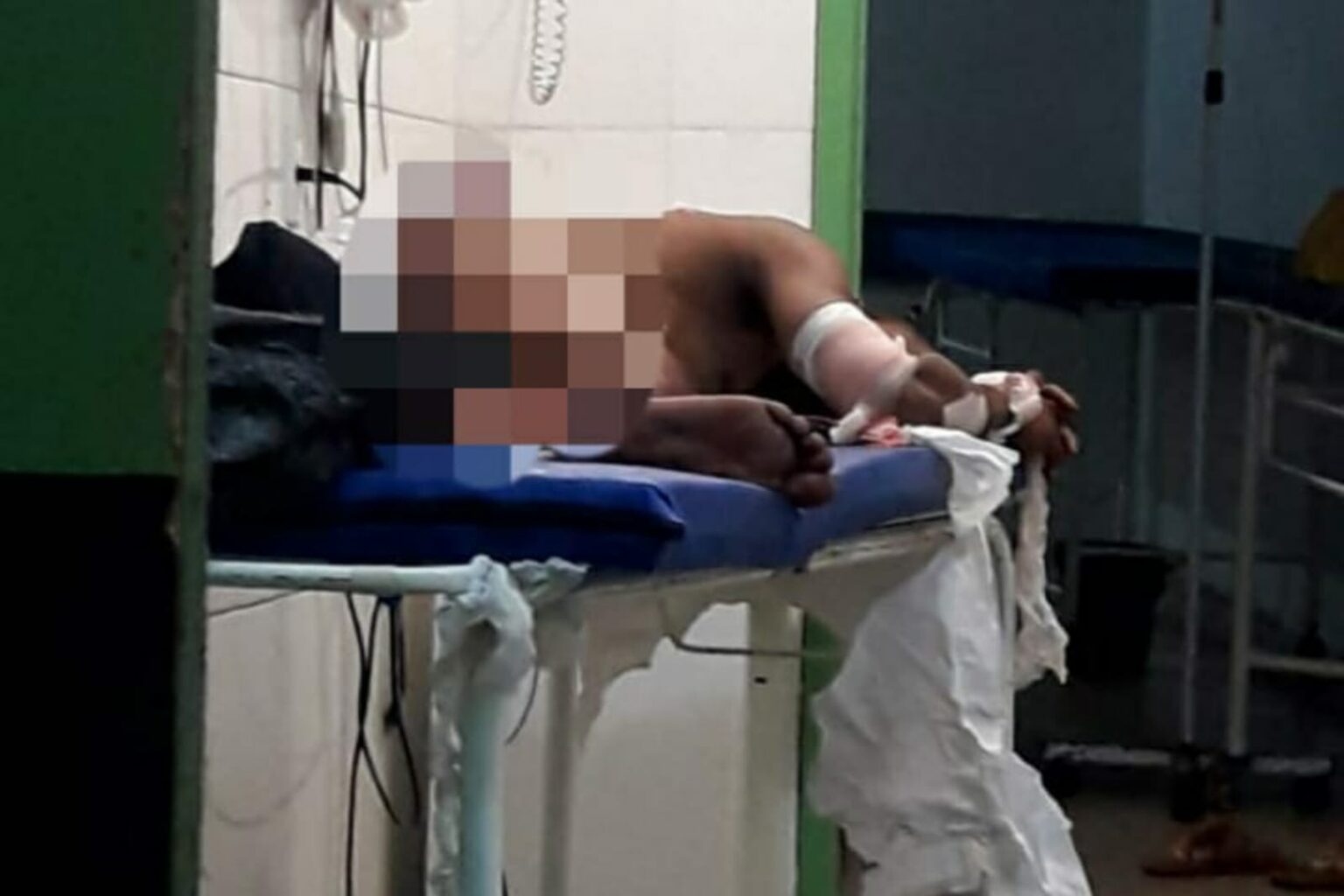 Homem é baleado em bar de Parauapebas