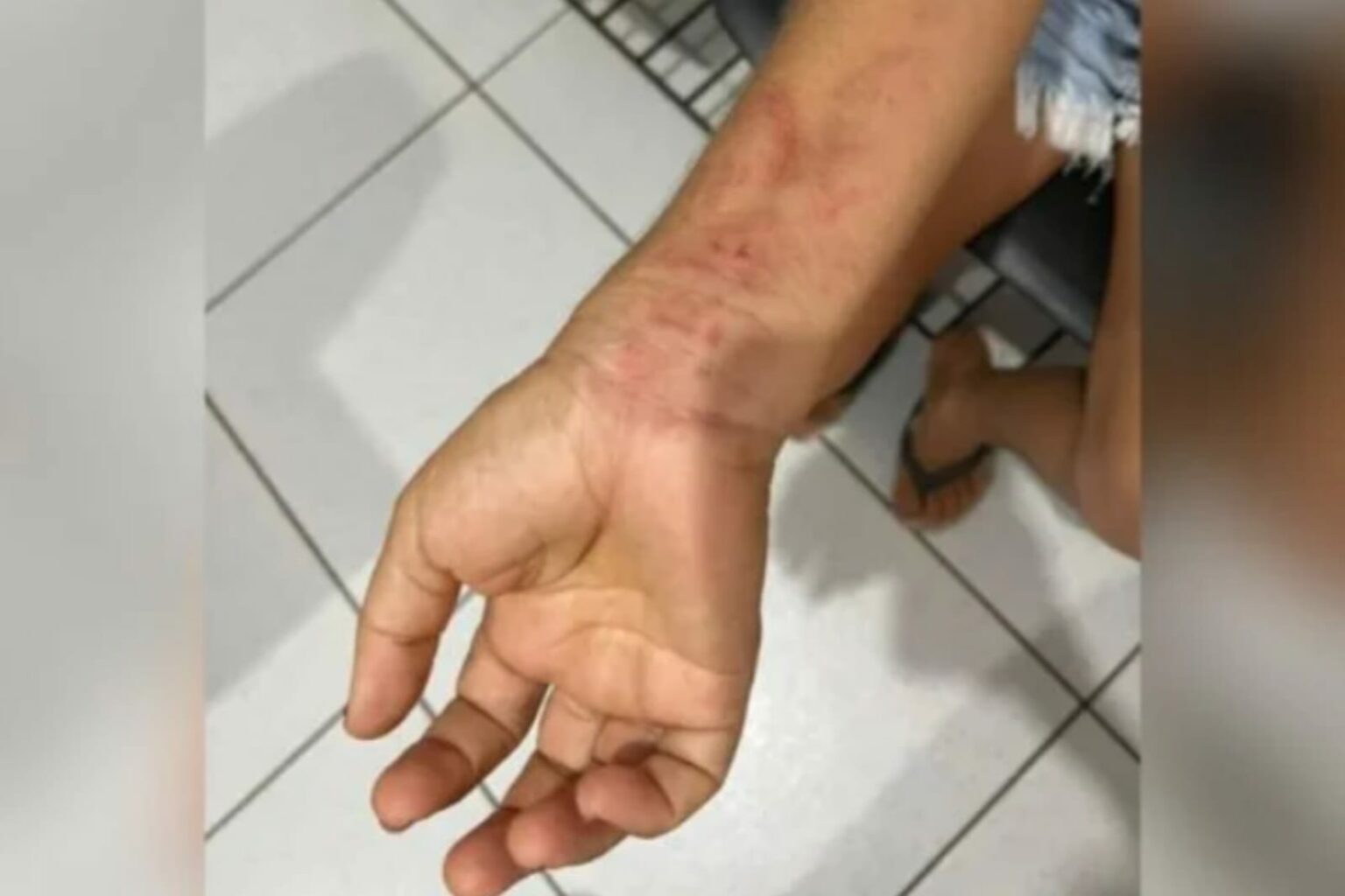 Mulher fica 8 meses em cárcere privado, engravida e é obrigada a abortar