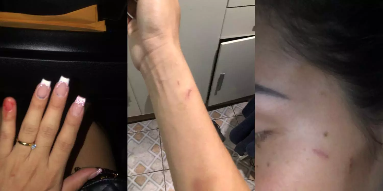 Jovem é agredida por casal e expulsa por seguranças de casa de show no Pará