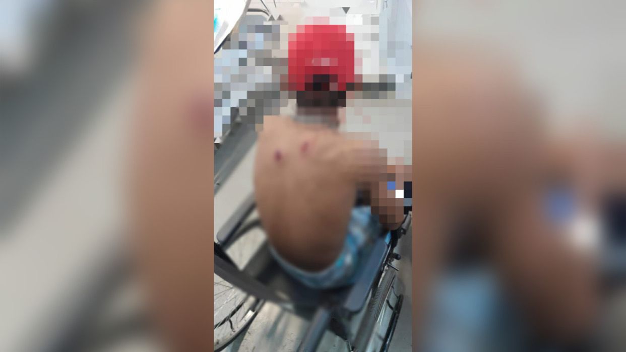 Adolescente de 16 anos é alvejado a tiros em Parauapebas