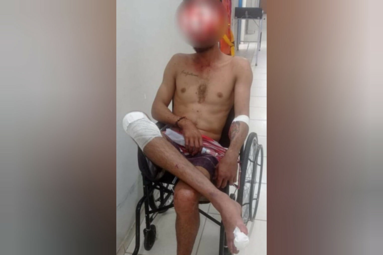 “Netinho” sobrevive a tentativa de execução no interior do Pará