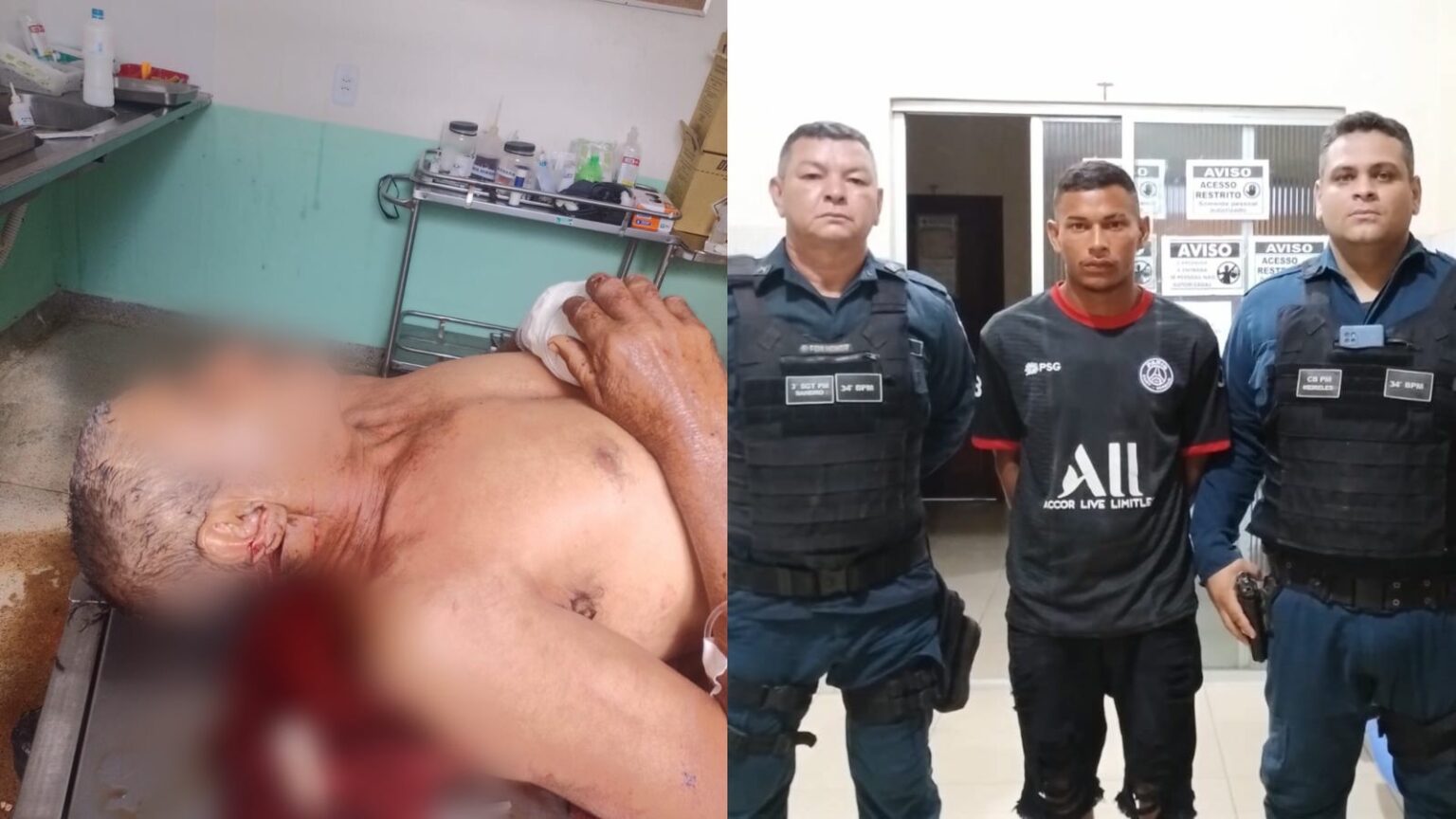 Ladrão ataca homem com golpes de facão na zona rural de Marabá