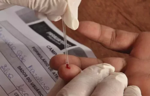 Casos de HIV crescem entre a chamada população ativa de Parauapebas
