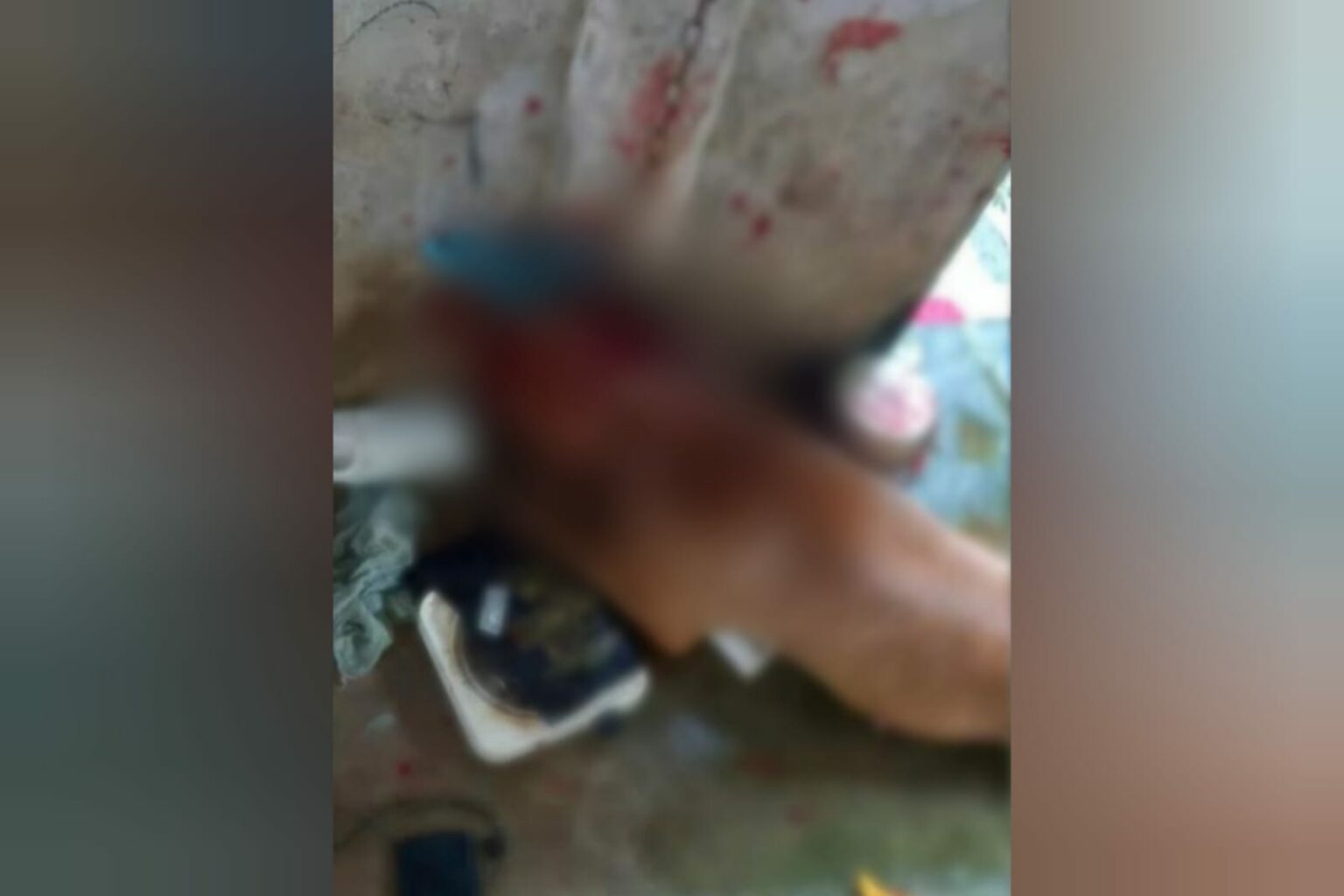 Pitbull é morto após atacar homem no Marajó