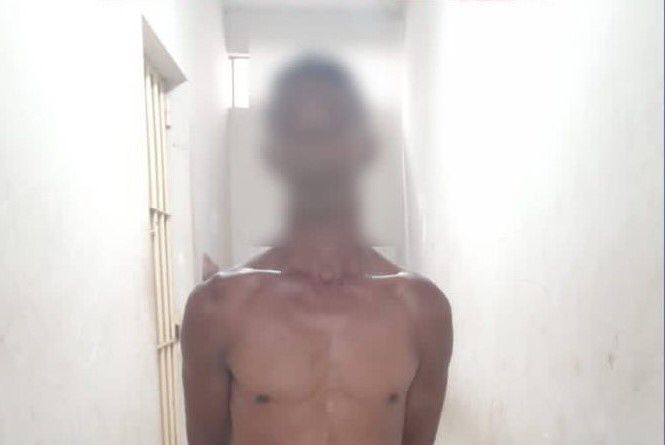 Homem é preso por espancar e jogar ex-mulher de escada no nordeste do Pará