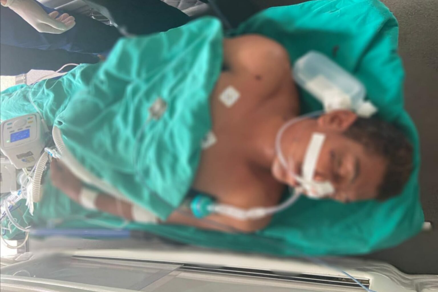 Homem é encontrado com faca cravada no rosto em Parauapebas