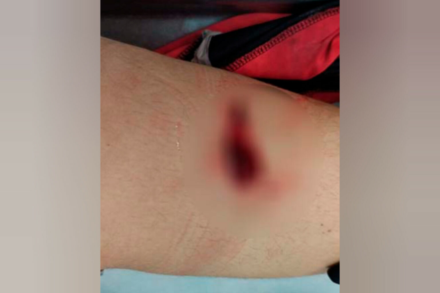 Estudante leva facada durante ensaio de festa junina de escola no Pará