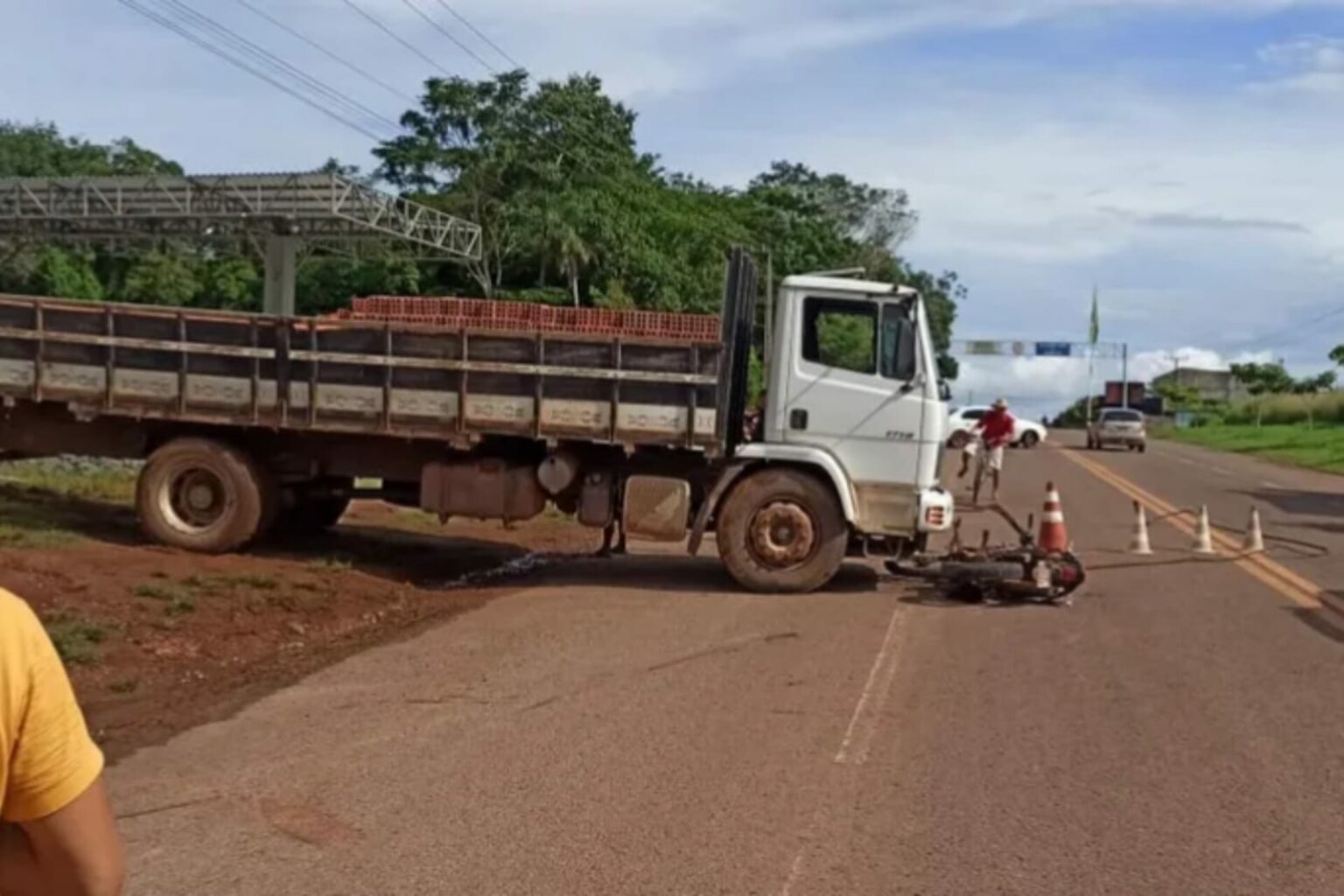 Homem tem parte da perna arrancada após sofrer acidente no Pará
