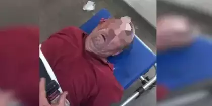 Aposentado fica surdo após ser espancado por segurança de feira