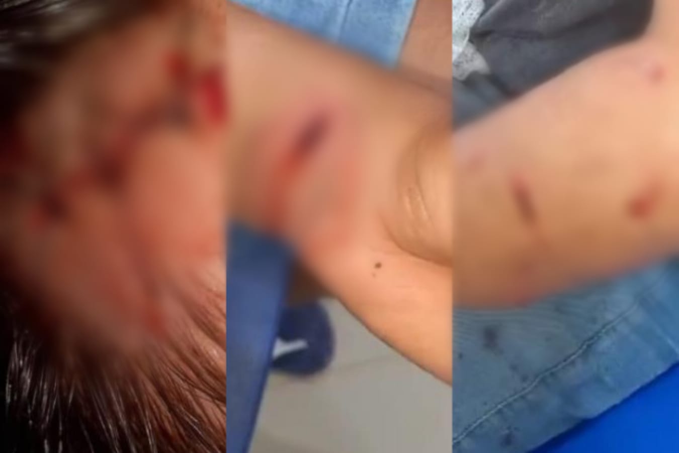 Irmãos são atacados por onça-pintada no Pará