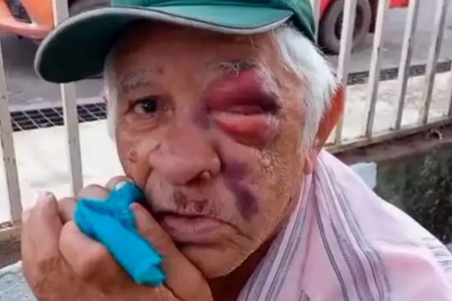 ​Idoso de 75 anos é agredido ao intervir em confusão no Pará