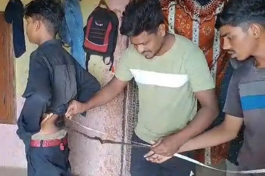 Menino com ‘rabo’ de 60 centímetros é adorado como um deus na Índia