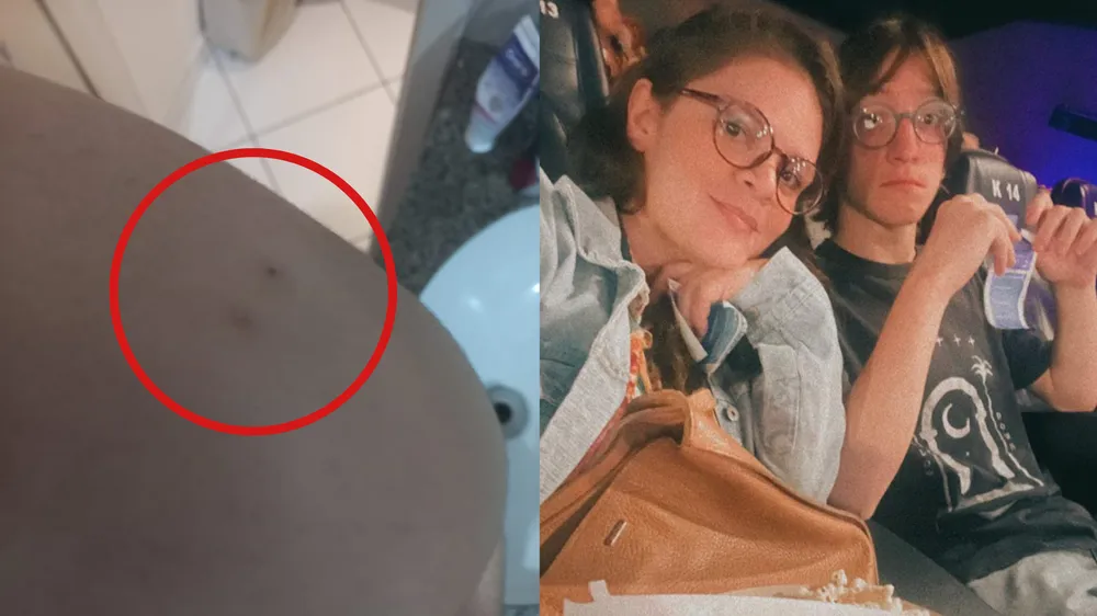 Morcego invade apartamento e morde adolescente no Pará