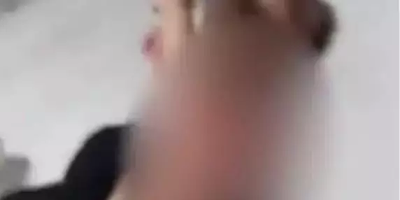 Durante discussão com o marido, mulher joga água fervente em bebê de dois meses