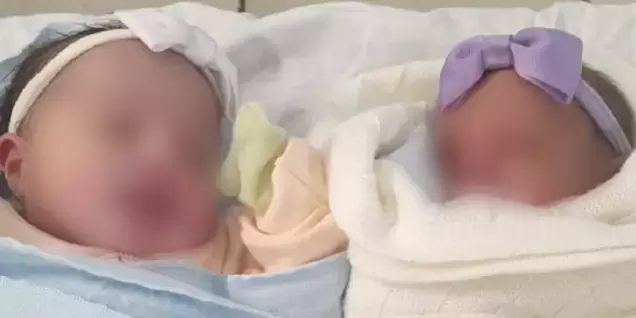 Mulher dá à luz gêmeas sem saber de gravidez e uma das bebês cai na privada