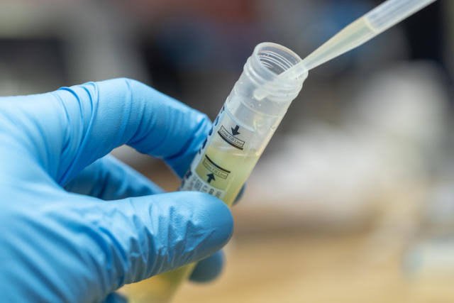 SUS oferece novos testes para diagnóstico de IST