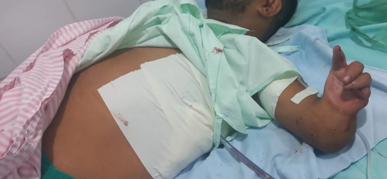 Homem é esfaqueado pela companheira no Pará