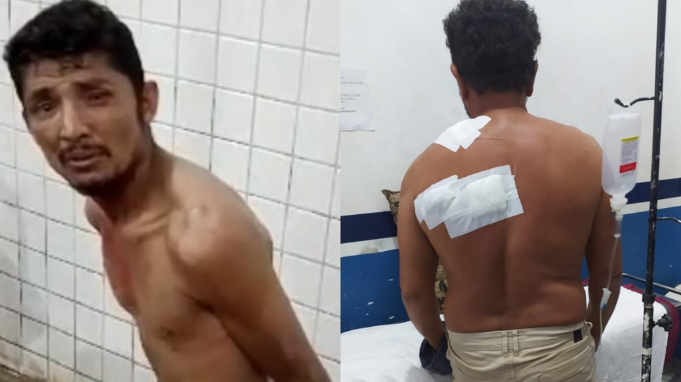 Policial militar é esfaqueado nas costas por vizinho no Pará