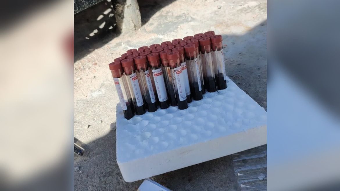 Família encontra tubos de sangue jogados em via pública no Pará