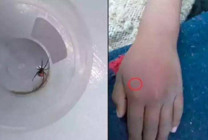 Criança deixa viúva-negra picar a própria mão para tentar virar o Homem-Aranha