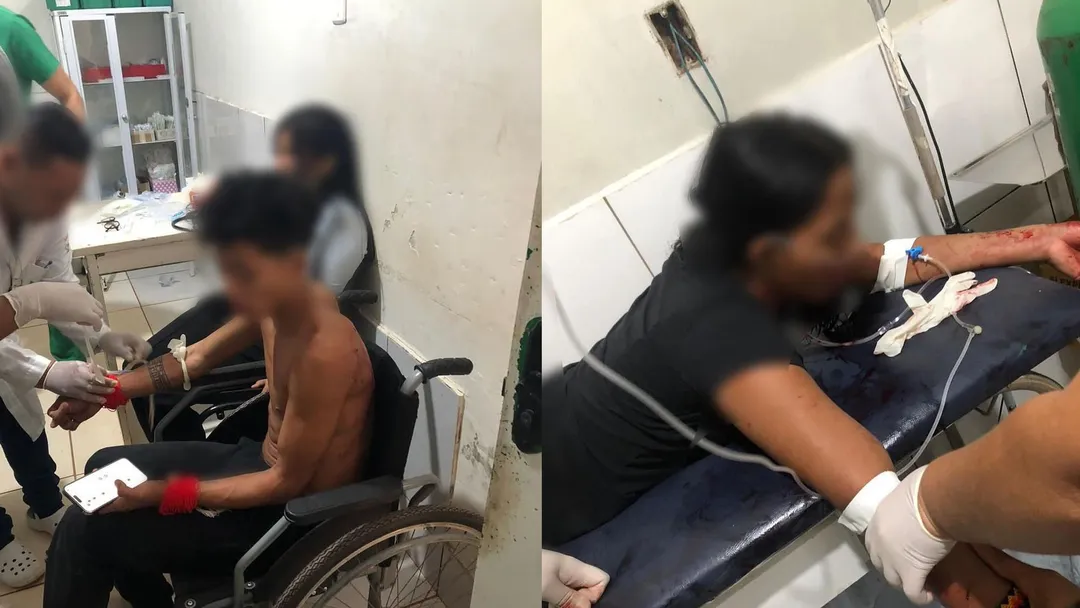 Funai atua para responsabilizar envolvidos em conflito que feriu indígenas no Pará