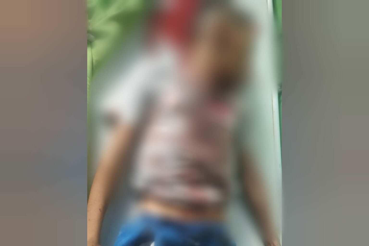 Criança morre após cair de moto na zona rural de Marabá