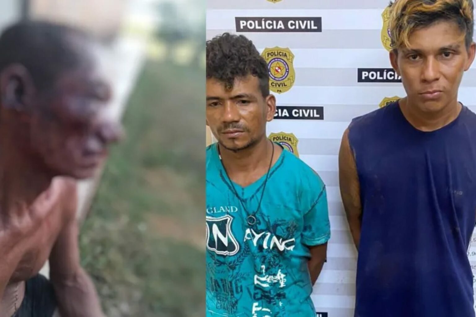 Deficiente visual tem orelha cortada por criminosos em Alenquer
