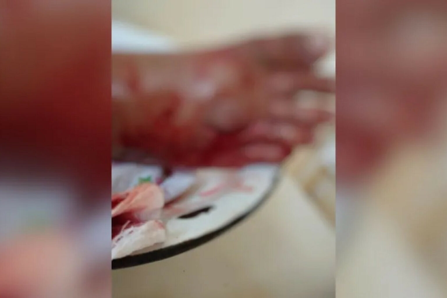 Adolescente é atacado por jacaré no Pará