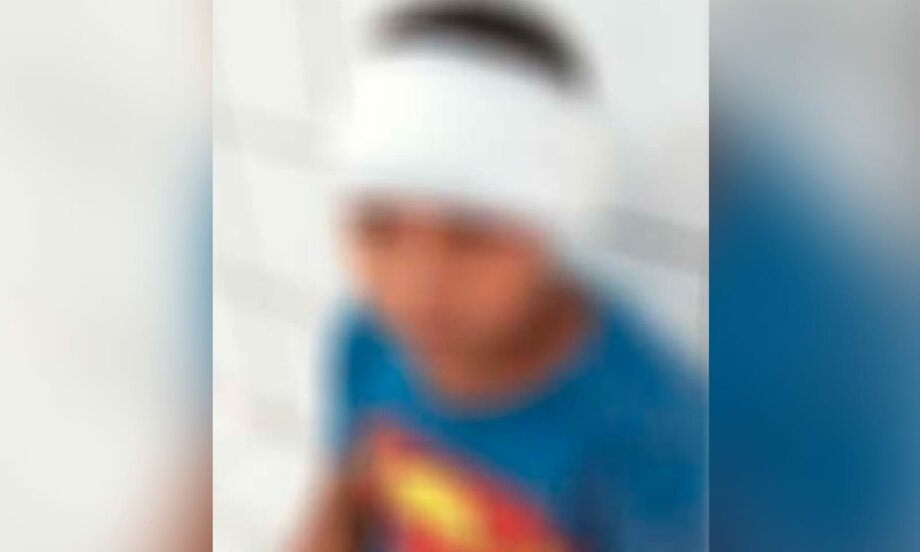 Criança é atingida na cabeça por tiro acidental após brincar com espingarda no Pará