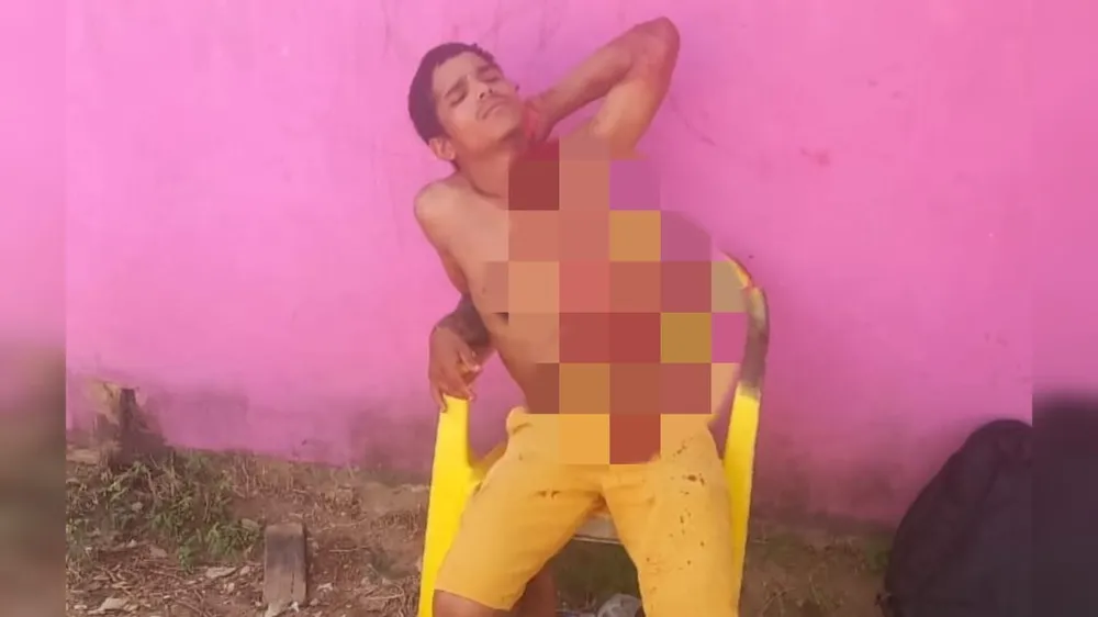 Jovem é esfaqueado no pescoço após ser acusado de furto no Pará