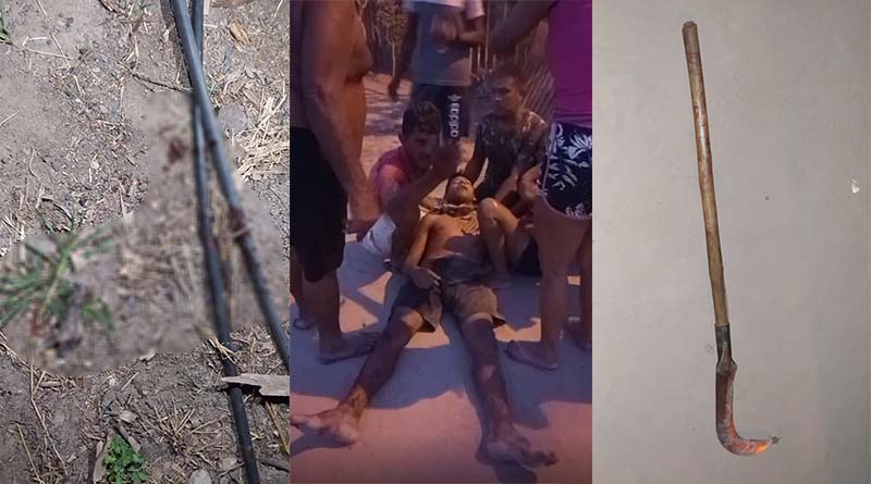 Homem é atingido com golpe de foice após desavença com vizinho no Pará