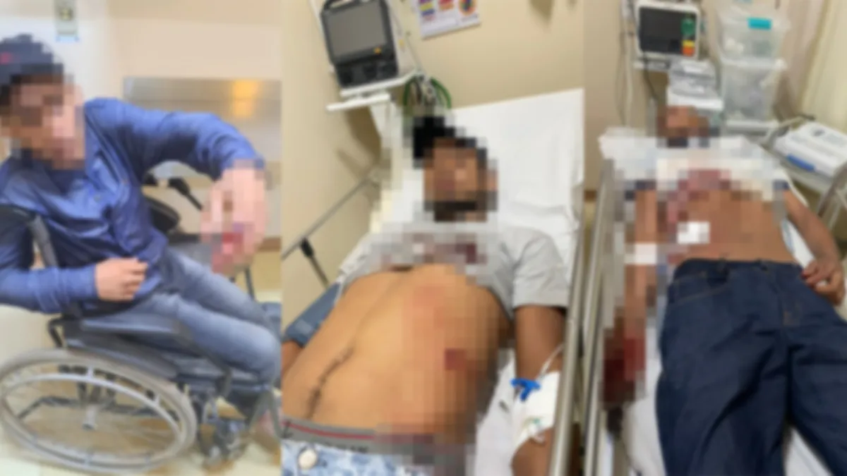 Tentativa de homicídio em bar deixa 3 pessoas baleadas no Pará