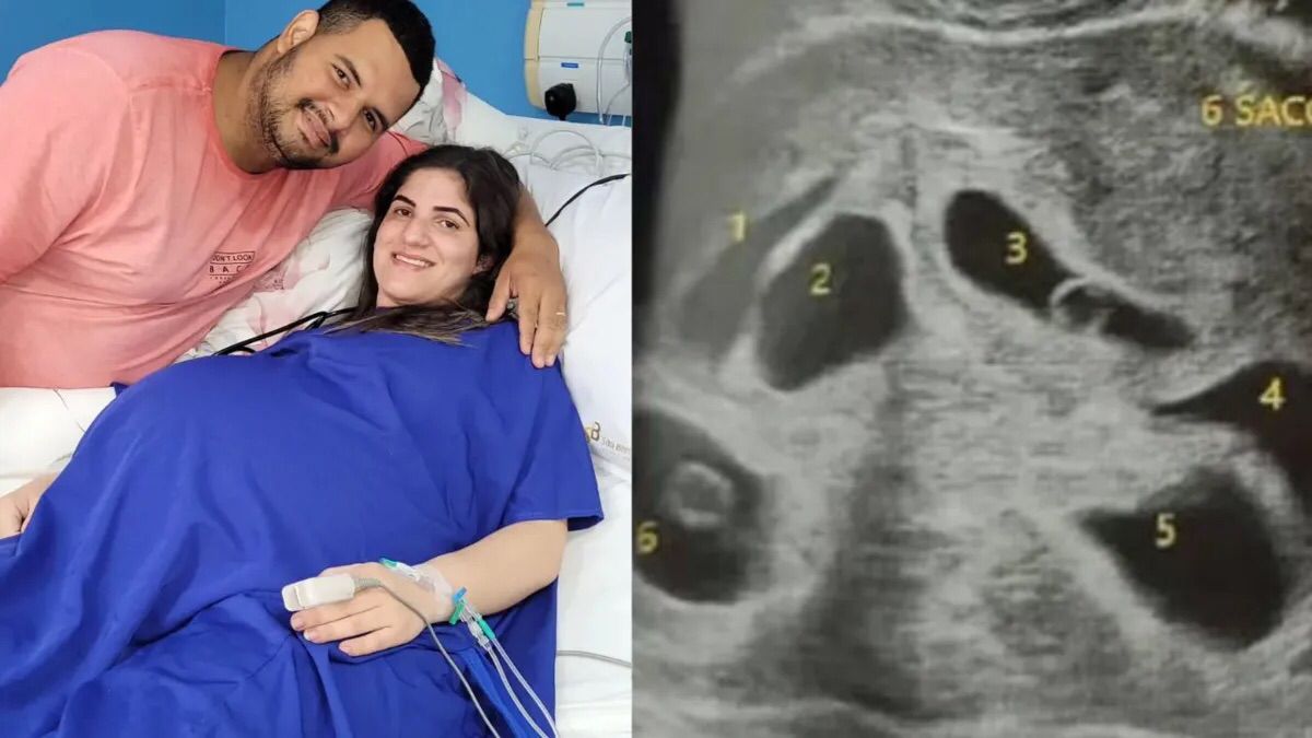 Mãe dá à luz sêxtuplos em parto de apenas 10 minutos