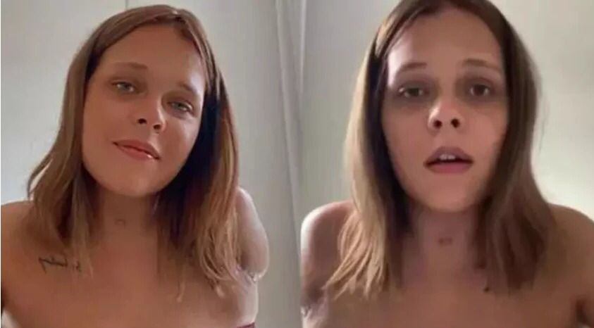 Jovem é internada com asma e sai de hospital com braço amputado