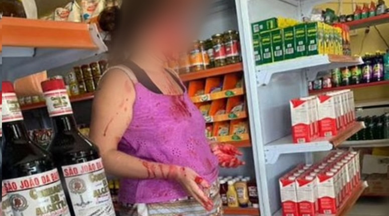 Ex-sogra agride com socos e tapas a ex-nora em Novo Progresso